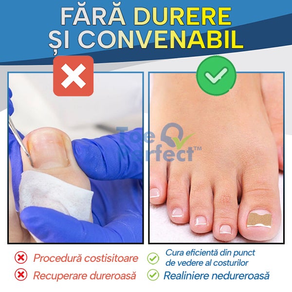 ToePerfect™ – Set 50 Plasturi Pentru Corectarea Unghiei Încarnate