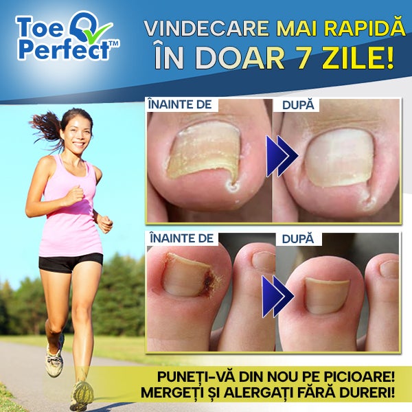 ToePerfect™ – Set 50 Plasturi Pentru Corectarea Unghiei Încarnate