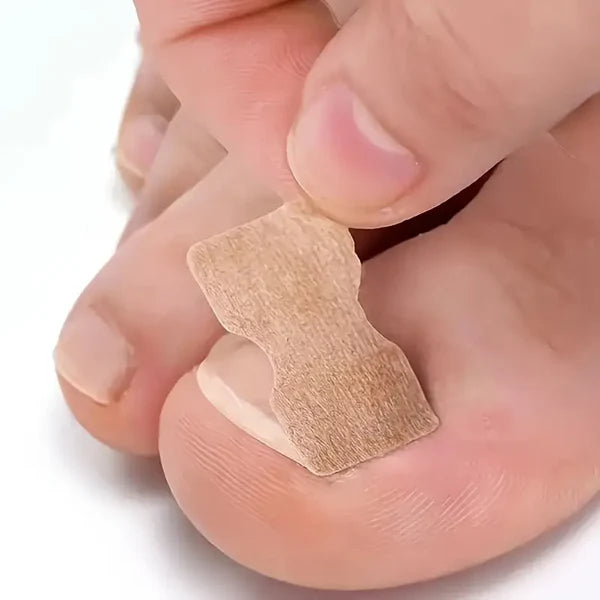 ToePerfect™ – Set 50 Plasturi Pentru Corectarea Unghiei Încarnate