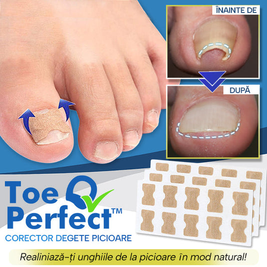 ToePerfect™ – Set 50 Plasturi Pentru Corectarea Unghiei Încarnate