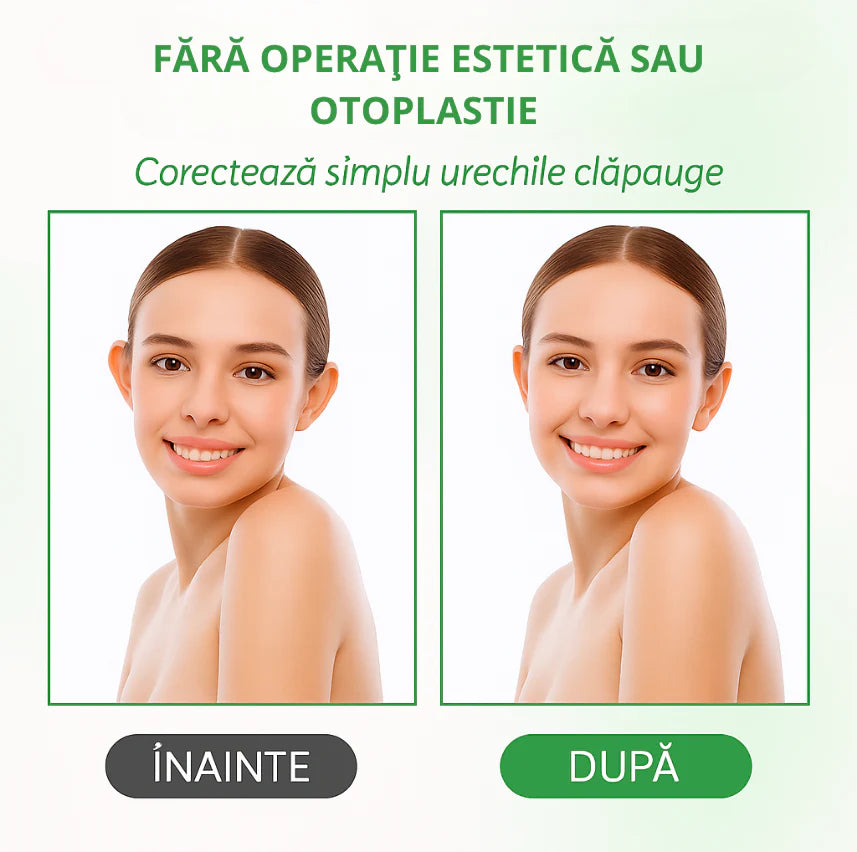 EarFix - Set 4 plasturi corectori pentru ureche